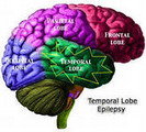 Эпилепсия: священная падучая болезнь