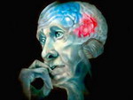 Как замедлить болезнь Альцгеймера?