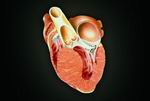 Три вида кардиомиопатии