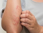 10 тревожных симптомов, которые будут видны на коже